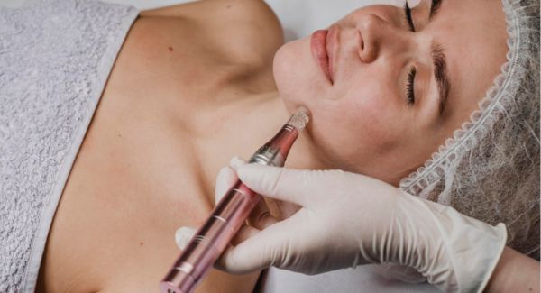 ✨ DERMAPEN | Protocolo de Renovación y Regeneración Cutánea ✨